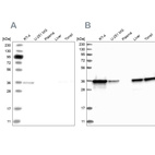 Western blot analysis using Anti-PDXK antibody HPA030198 (A) shows similar pattern to independent antibody HPA030196 (B).