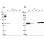 Western blot analysis using Anti-PDXK antibody HPA030198 (A) shows similar pattern to independent antibody HPA030196 (B).