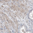 Immunohistochemical staining of human prostate shows weak to moderate cytoplasmic positivity in smooth muscle cells.
