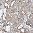 Immunohistochemical staining of human kidney shows weak to moderate cytoplasmic positivity in cells in tubules.