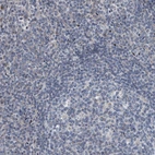 Immunohistochemical staining of human tonsil shows low positivity in non-germinal center cells as expected.