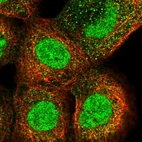 Immunofluorescent staining of human cell line A-431 shows localization to nucleus & cytosol.