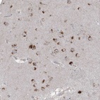 Anti-AGPS Antibody