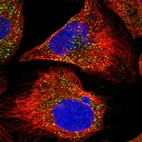 Immunofluorescent staining of human cell line U-2 OS shows localization to peroxisomes.