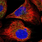 Immunofluorescent staining of human cell line U-2 OS shows localization to peroxisomes.