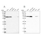 Western blot analysis using Anti-AGPS antibody HPA030210 (A) shows similar pattern to independent antibody HPA030211 (B).