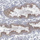 Immunohistochemical staining of human endometrium shows moderate granular cytoplasm positivity in glandular cells.