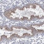 Immunohistochemical staining of human endometrium shows moderate granular cytoplasm positivity in glandular cells.