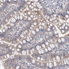 Immunohistochemical staining of human gastrointestinal shows moderate granular cytoplasmic positivity in glandular cells.
