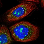 Immunofluorescent staining of human cell line A-431 shows localization to nucleoli & peroxisomes.