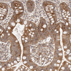 Immunohistochemical staining of human Small intestine shows moderate cytoplasmic positivity in glandular cells.