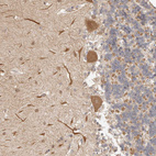 Anti-AFDN Antibody