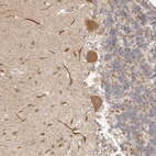 Immunohistochemical staining of human Cerebellum shows moderate cytoplasmic positivity in Purkinje cells.