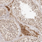 Immunohistochemical staining of human Testis shows moderate cytoplasmic positivity in Leydig cells and cells in seminiferous ducts.