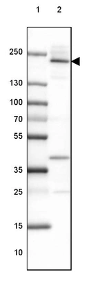 Lane 1: Marker [kDa] 250, 130, 100, 70, 55, 35, 25, 15, 10_br/_Lane 2: Human Esophagus tissue