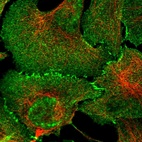 Immunofluorescent staining of human cell line U-2 OS shows localization to nuclear speckles, plasma membrane & cell junctions.