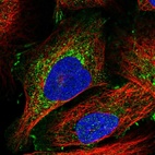 Immunofluorescent staining of human cell line U-2 OS shows localization to cytosol & cell junctions.