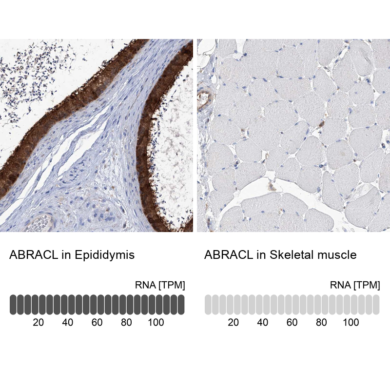 Anti-ABRACL Antibody