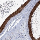 Immunohistochemical staining of human epididymis shows high expression.