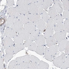 Immunohistochemical staining of human skeletal muscle shows low expression as expected.