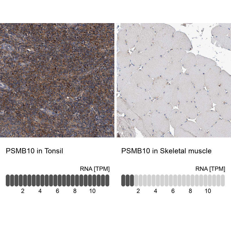 Rabbit Polyclonal Anti-PSMB10 Antibody - Buy for research - Highly ...