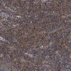 Immunohistochemical staining of human tonsil shows moderate cytoplasmic positivity in non-germinal center cells.