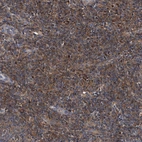 Immunohistochemical staining of human tonsil shows moderate cytoplasmic positivity in non-germinal center cells.