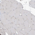 Immunohistochemical staining of human skeletal muscle shows no positivity in myocytes as expected.