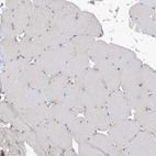 Immunohistochemical staining of human skeletal muscle shows no positivity in myocytes as expected.