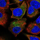 Immunofluorescent staining of human cell line A549 shows localization to cytosol.