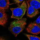 Immunofluorescent staining of human cell line A549 shows localization to cytosol.