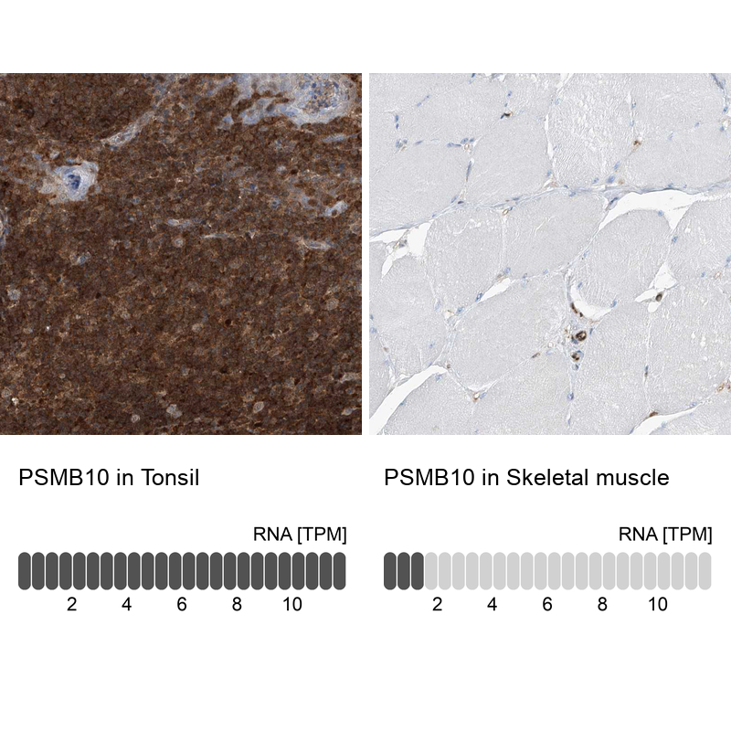 Anti-PSMB10 Antibody