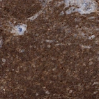Immunohistochemical staining of human tonsil shows strong cytoplasmic positivity in non-germinal center cells.