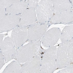 Immunohistochemical staining of human skeletal muscle shows no positivity in myocytes as expected.
