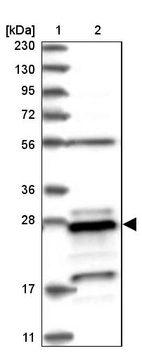 Lane 1: Marker [kDa] 230, 130, 95, 72, 56, 36, 28, 17, 11_br/_Lane 2: Human cell line RT-4