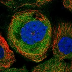 Immunofluorescent staining of human cell line A-431 shows localization to cytosol.
