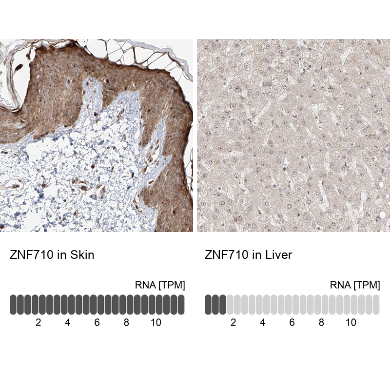 Anti-ZNF710 Antibody