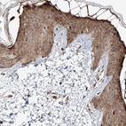 Immunohistochemical staining of human skin shows high expression.
