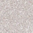 Immunohistochemical staining of human liver shows low expression as expected.