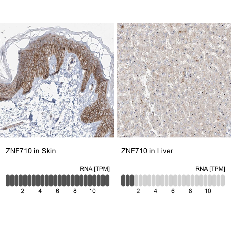 Anti-ZNF710 Antibody