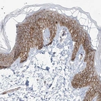Immunohistochemical staining of human skin shows high expression.