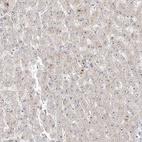 Anti-ZNF710 Antibody