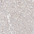 Immunohistochemical staining of human liver shows low expression as expected.