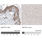 Anti-ZNF710 Antibody