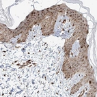 Immunohistochemical staining of human skin shows high expression.