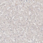 Immunohistochemical staining of human liver shows low expression as expected.