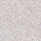 Immunohistochemical staining of human liver shows low expression as expected.
