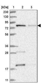 Lane 1: Marker [kDa] 230, 130, 95, 72, 56, 36, 28, 17, 11_br/_Lane 2: Human cell line RT-4_br/_Lane 3: Human cell line U-251MG sp