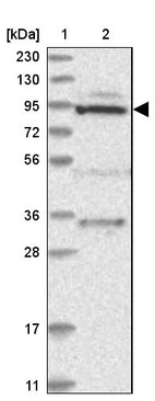Lane 1: Marker [kDa] 230, 130, 95, 72, 56, 36, 28, 17, 11_br/_Lane 2: Human cell line RT-4