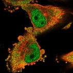 Immunofluorescent staining of human cell line U-251 MG shows localization to nucleoplasm & cytosol.
